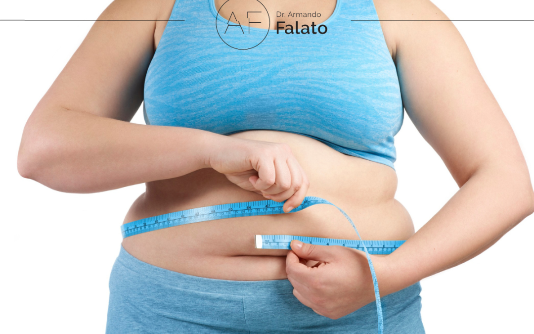 Bypass gastrico: cosa sapere