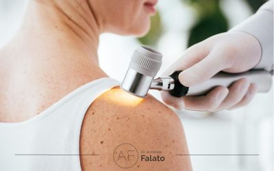 Rimozione di un melanoma, cosa sapere